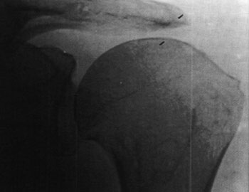 05_01_01_figura3
