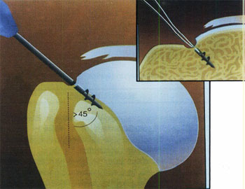 05_01_01_figura8