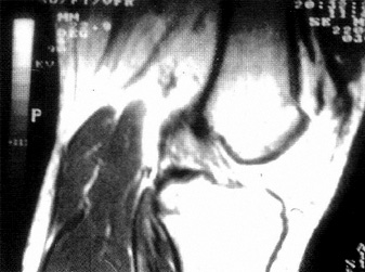 05_01_04_fig2