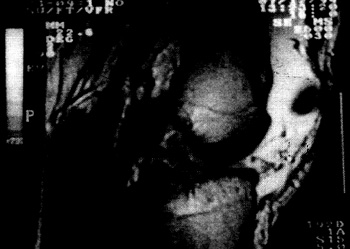 05_01_04_fig8