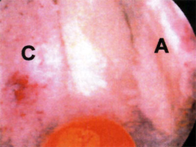 08_02_01_fig6