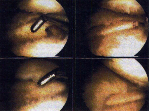 08_02_03_fig4
