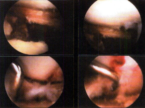 08_02_03_fig6