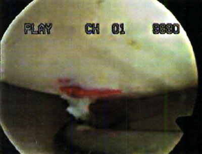 08_02_07_fig3