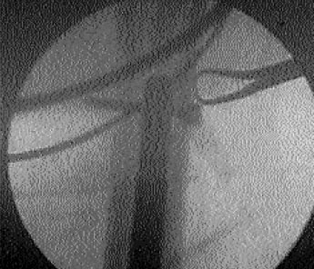 09_01_07_fig10a