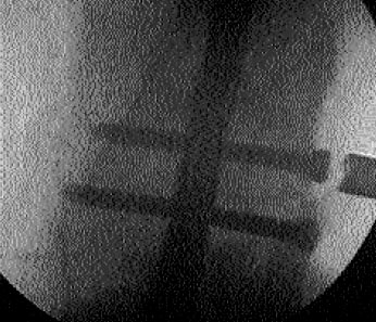 09_01_07_fig10b