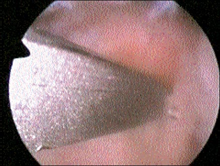 09_01_07_fig5