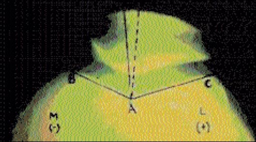 09_02_03_fig1
