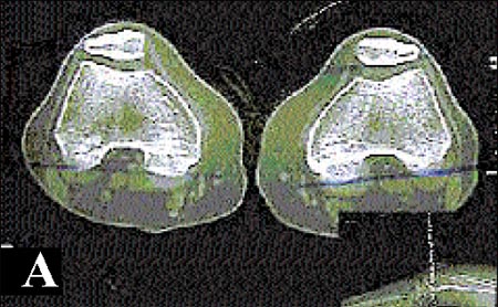 09_02_03_fig2a