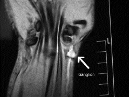 10_1_1_fig2