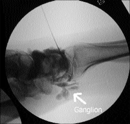 10_1_1_fig3