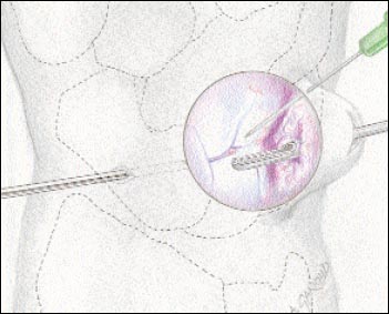 10_2_2_fig3