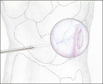 10_2_2_fig4