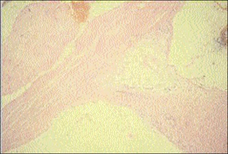 10_1_3_fig6