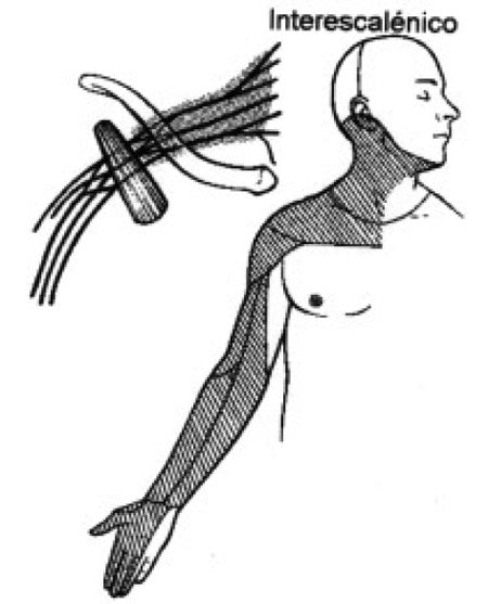 11_1_3_fig6
