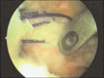 11_1_4_fig4