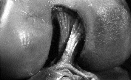 11_1_5_fig1