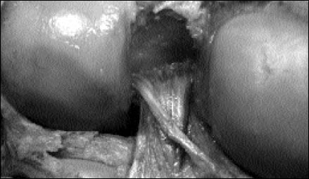 11_1_5_fig2