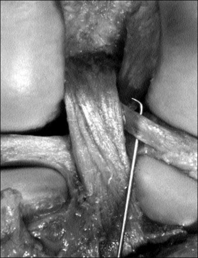 11_1_5_fig3