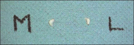 11_1_6_fig2