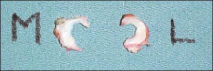 11_1_6_fig3