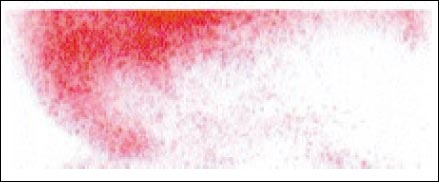 11_1_6_fig5