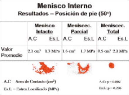 11_1_6_tabla1