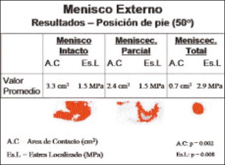 11_1_6_tabla2