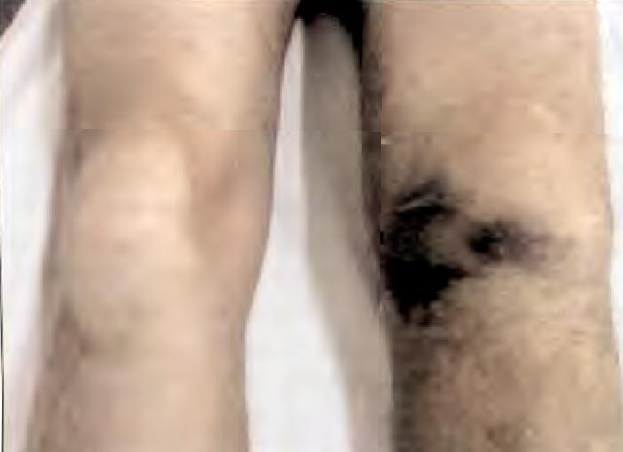 Figura 1