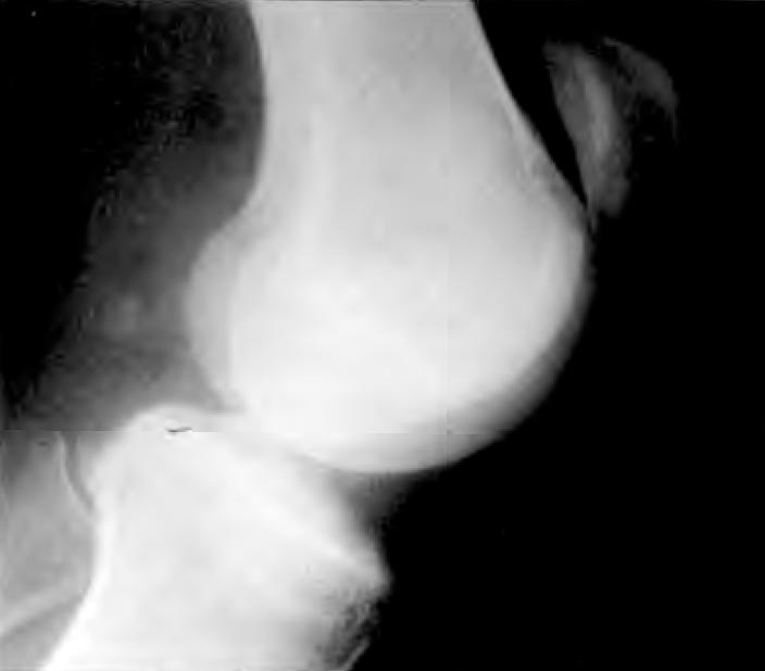 Figura 2