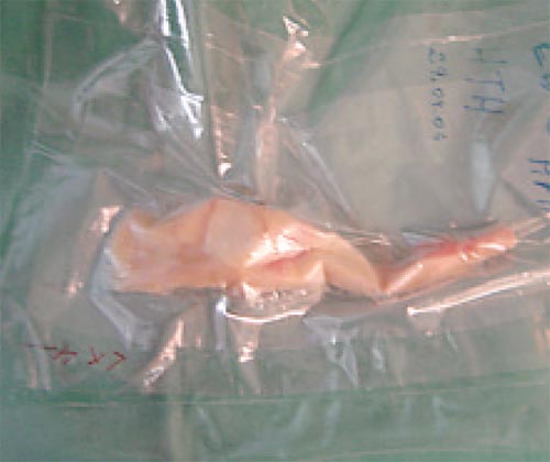 13_2_5_fig1