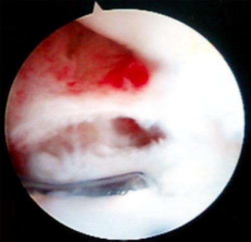 13_2_06_fig3