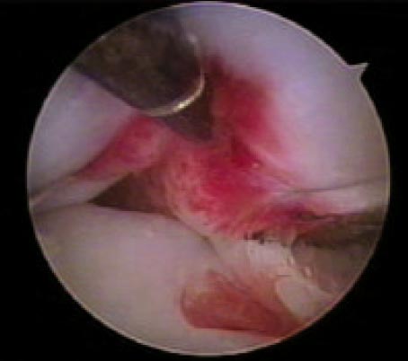 13_2_06_fig6