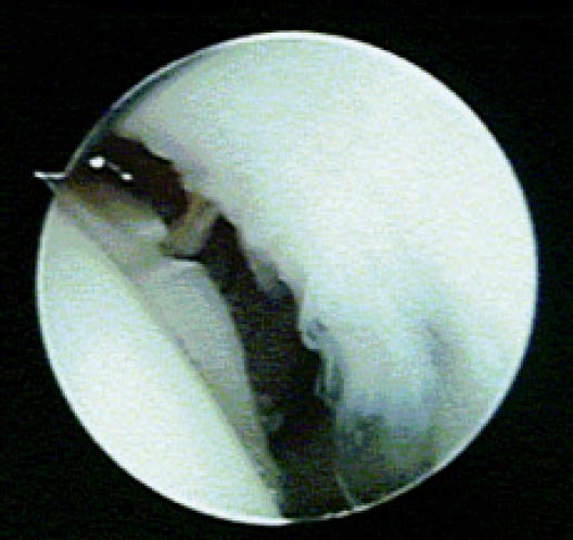 13_2_06_fig7