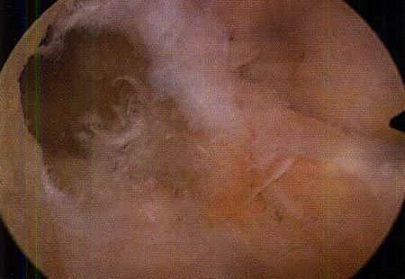 14_01_04_fig5