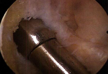 14_01_04_fig6