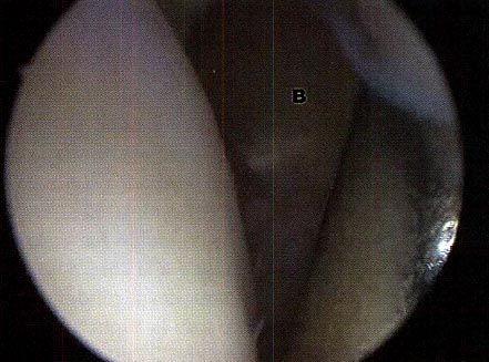 14_01_09_fig8