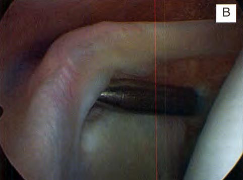 14_02_02_fig1b
