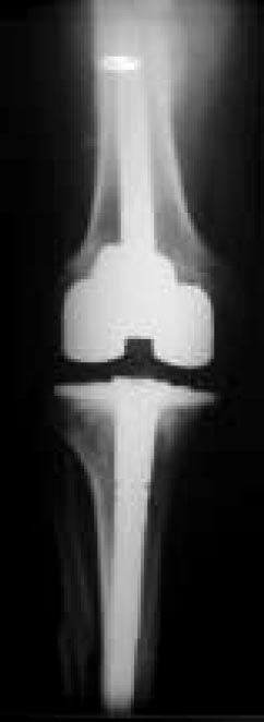 15_1_10_fig6