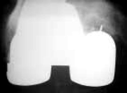 15_1_10_fig7
