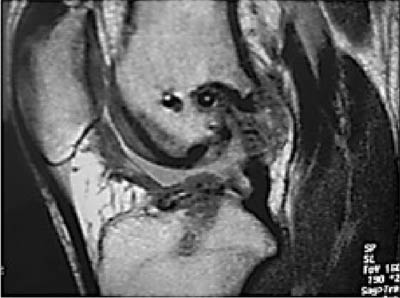 fig1