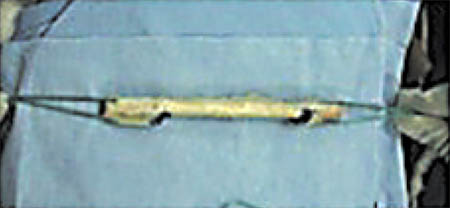 fig2