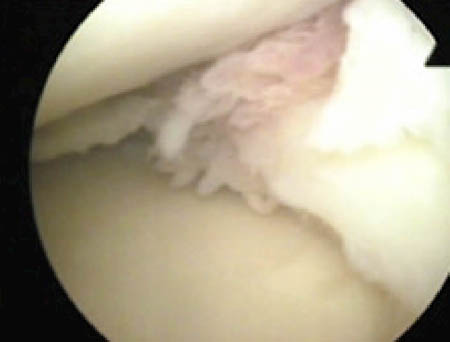 fig1