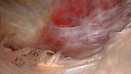 fig1