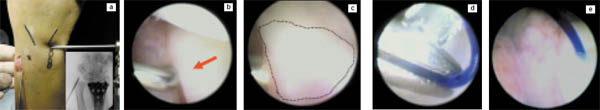 fig6