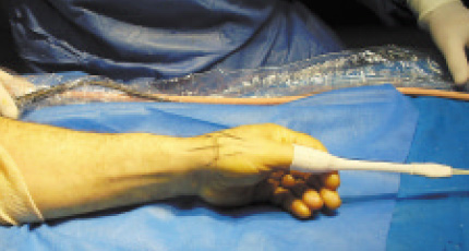 fig2