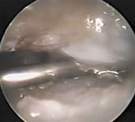fig4