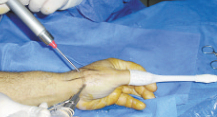 fig5