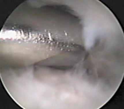 fig6