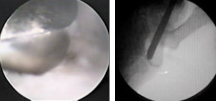 fig7y8
